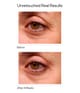 Murad Resurgence Augenserum 15 ml 767332603827 pack-shot_ch